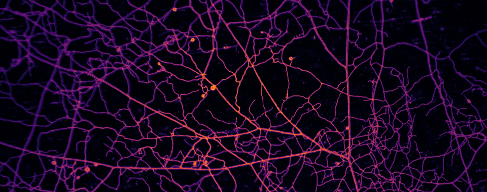 Branching filaments studded with spore sacs all in false color to indicate depth.