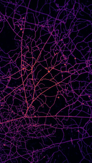 Branching filaments in a tangled web in false color to indicate depth.