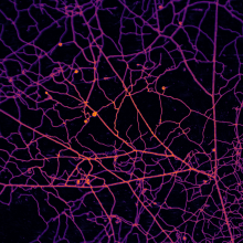 Branching filaments studded with spore sacs all in false color to indicate depth.